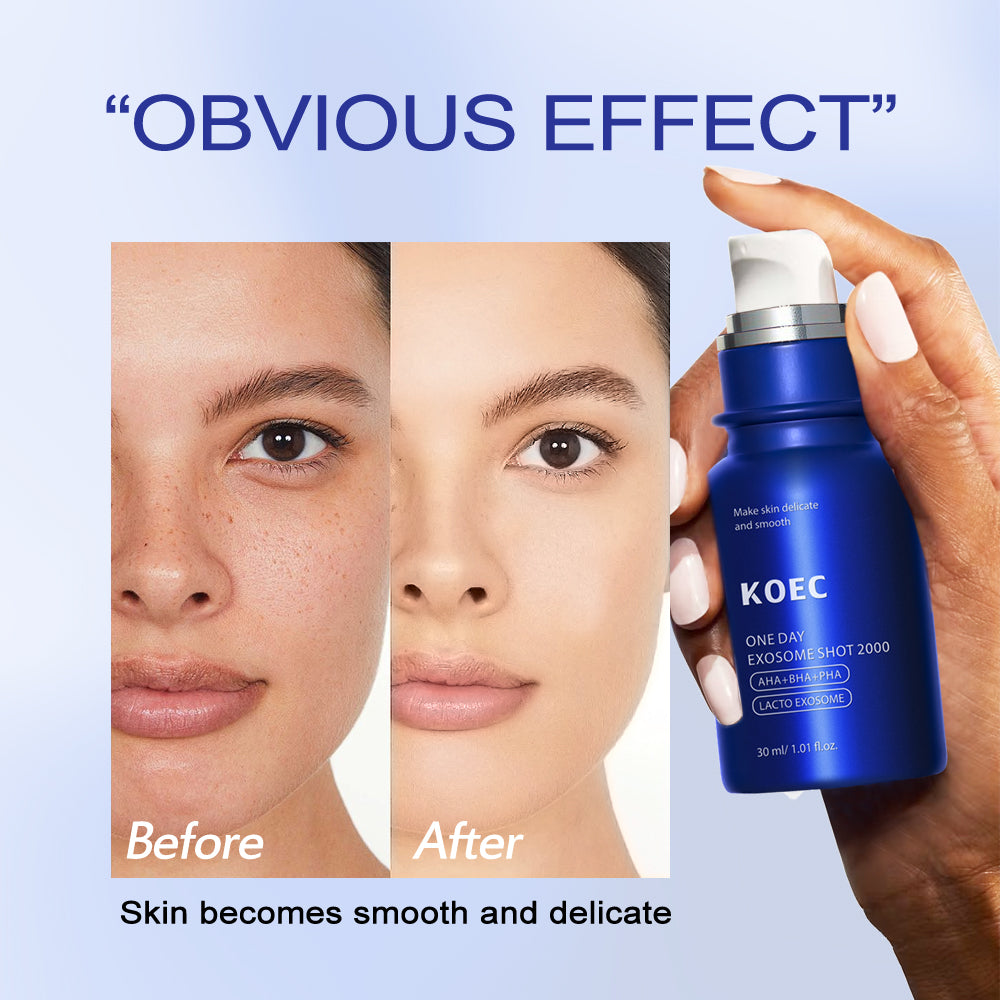 Exosome Face Serum 2000 - Advanced Pore Treatment & Hydration